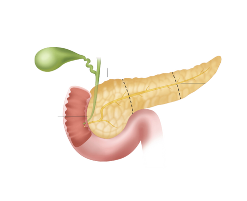 Diabetes Package image 0